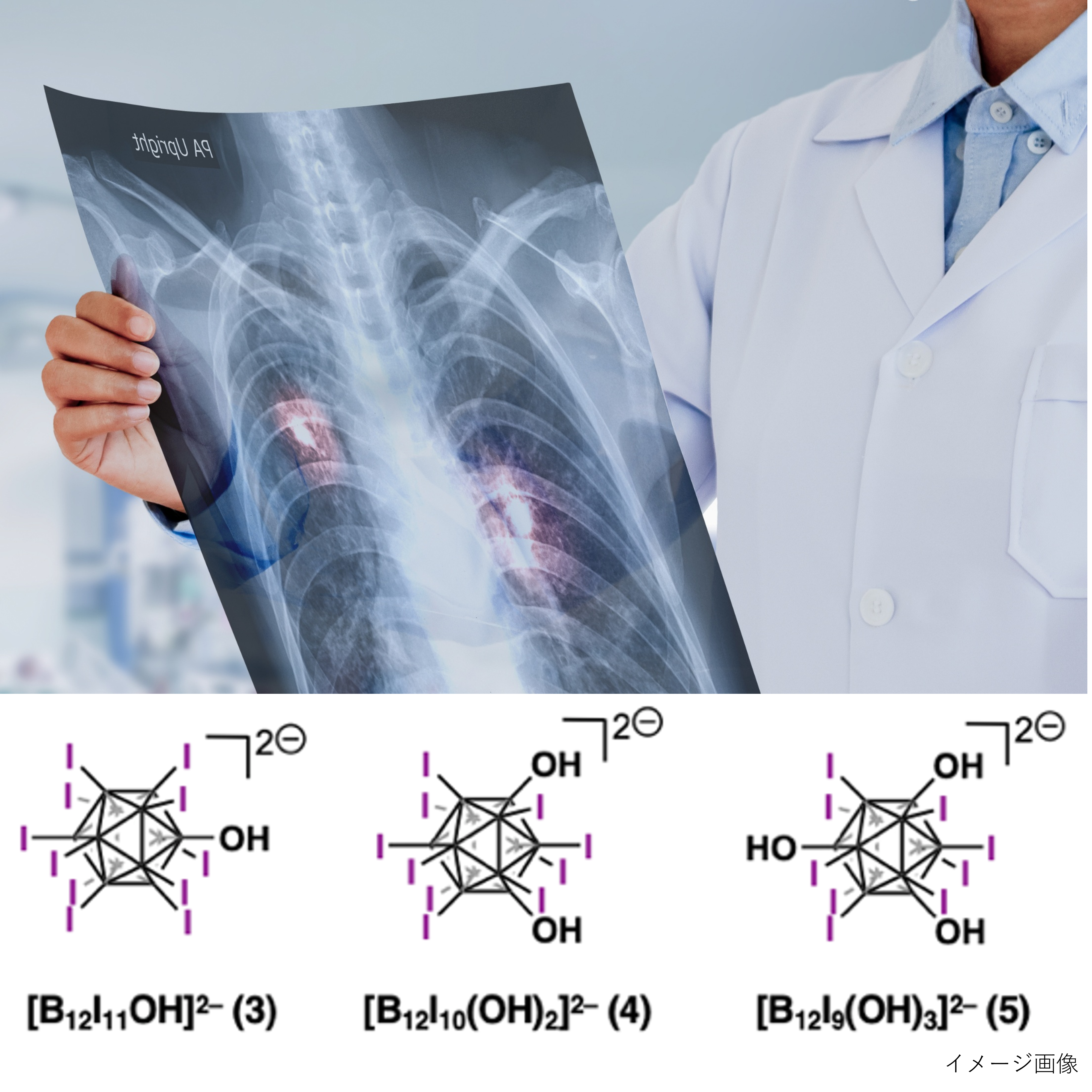 高造影・低負担の両立に向けた新発想のX線・CT造影剤設計［信州大学・繊維学部］